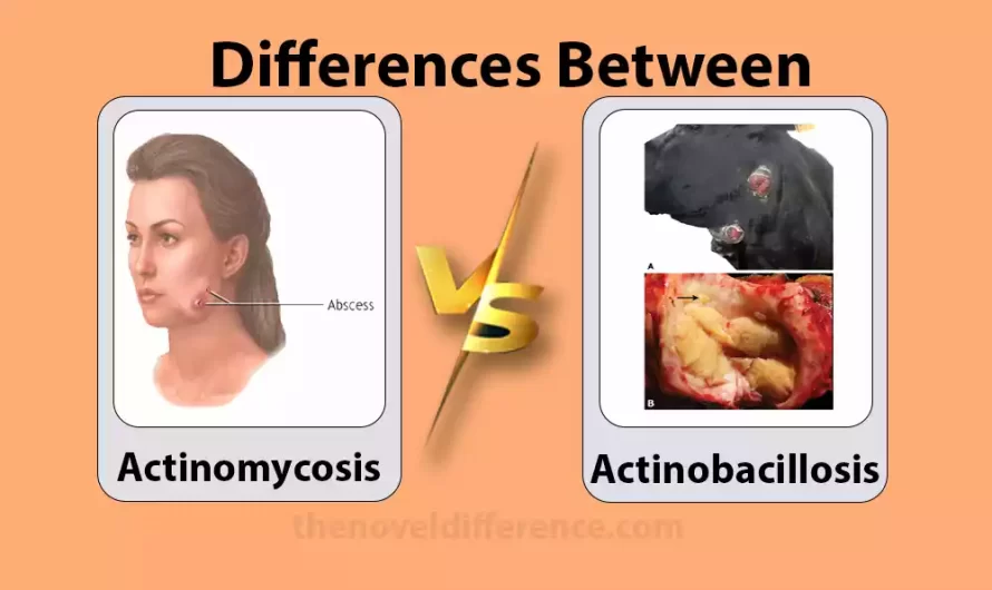 Difference Between Actinomycosis and Actinobacillosis
