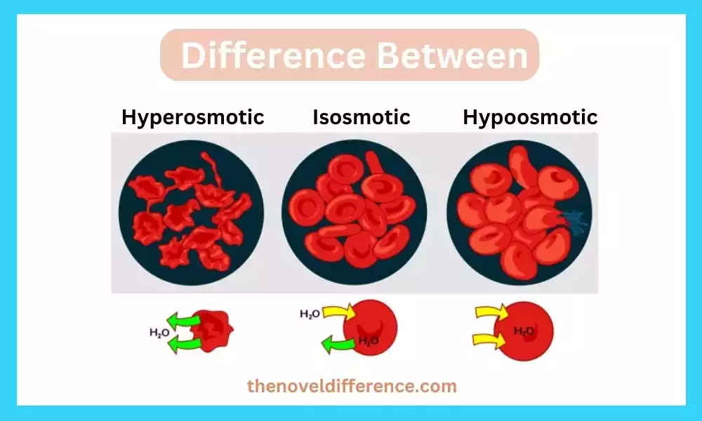 Isosmotic Hyperosmotic and Hypoosmotic
