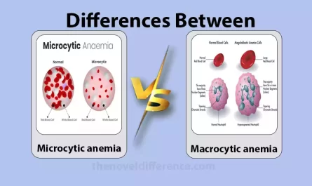 microcytic and macrocytic anemia
