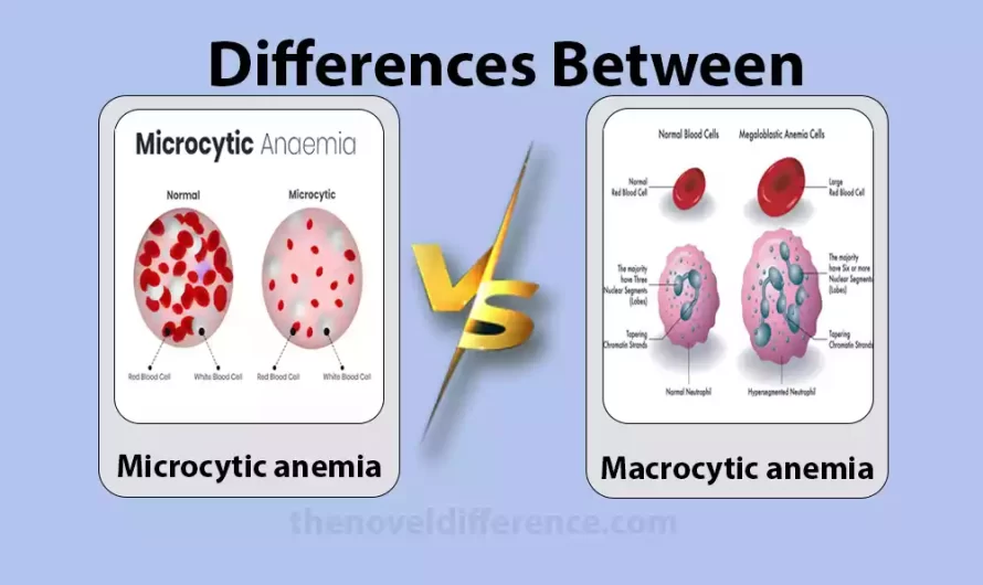 Difference Between Microcytic and Macrocytic Anemia