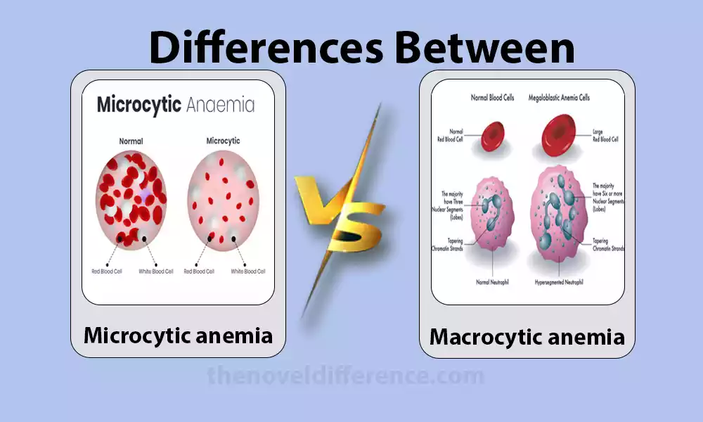 microcytic and macrocytic anemia