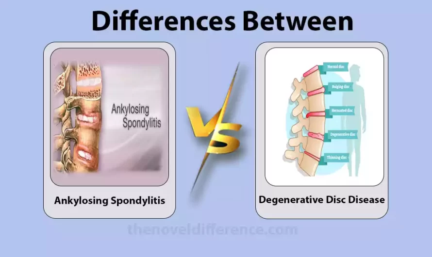 Difference Between Ankylosing Spondylitis and Degenerative Disc Disease