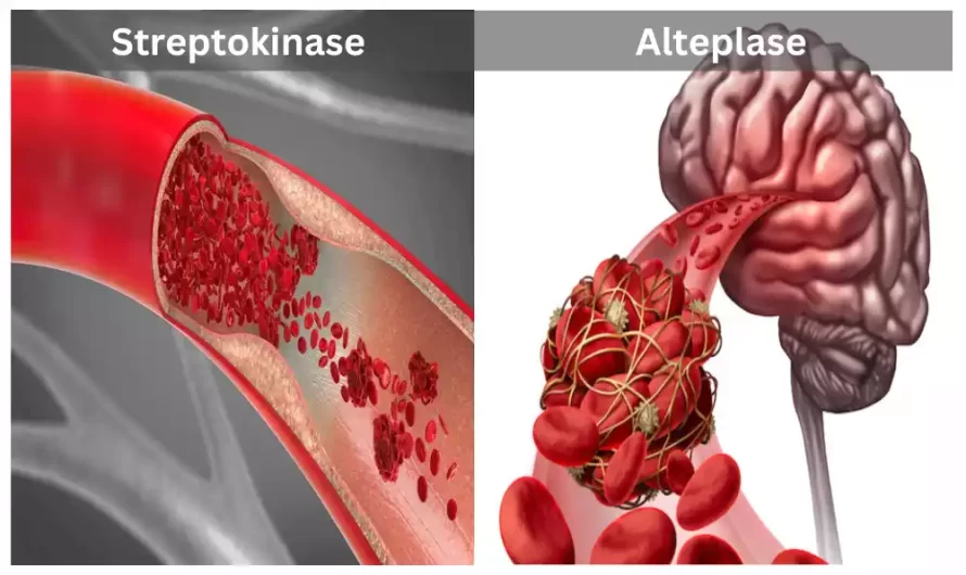Between Streptokinase and Alteplase the top 12 difference