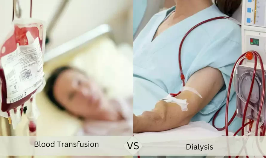 Blood Transfusion and Dialysis best 9 difference