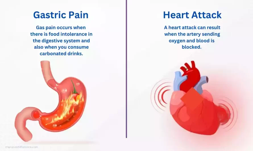 Difference Between Heart Attack and Gastric Pain