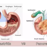 Gastritis and Pancreatitis
