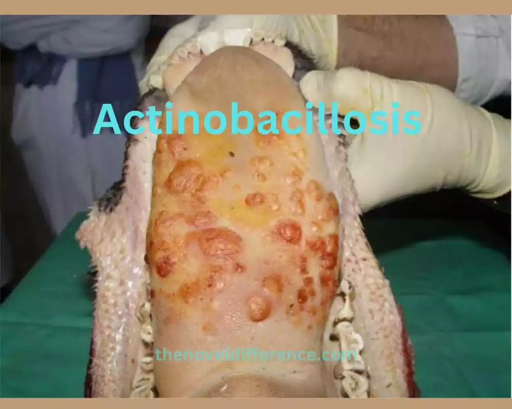 Actinobacillosis