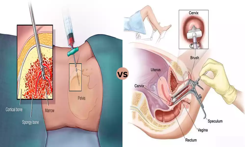 Biopsy and Pap Smear the best 10 difference