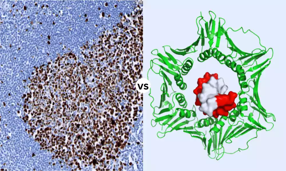 What Is The Difference Between PCNA and Ki67