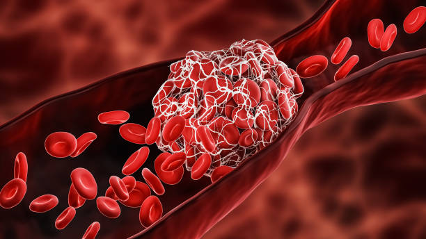 Fibrinolysis