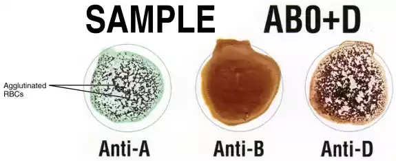 Hemagglutination