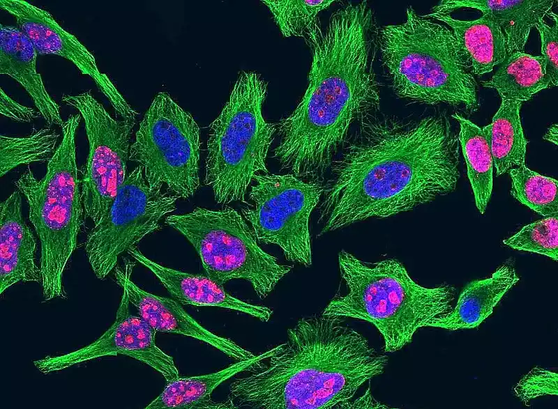 Ki67 (Marker of Cell Proliferation)