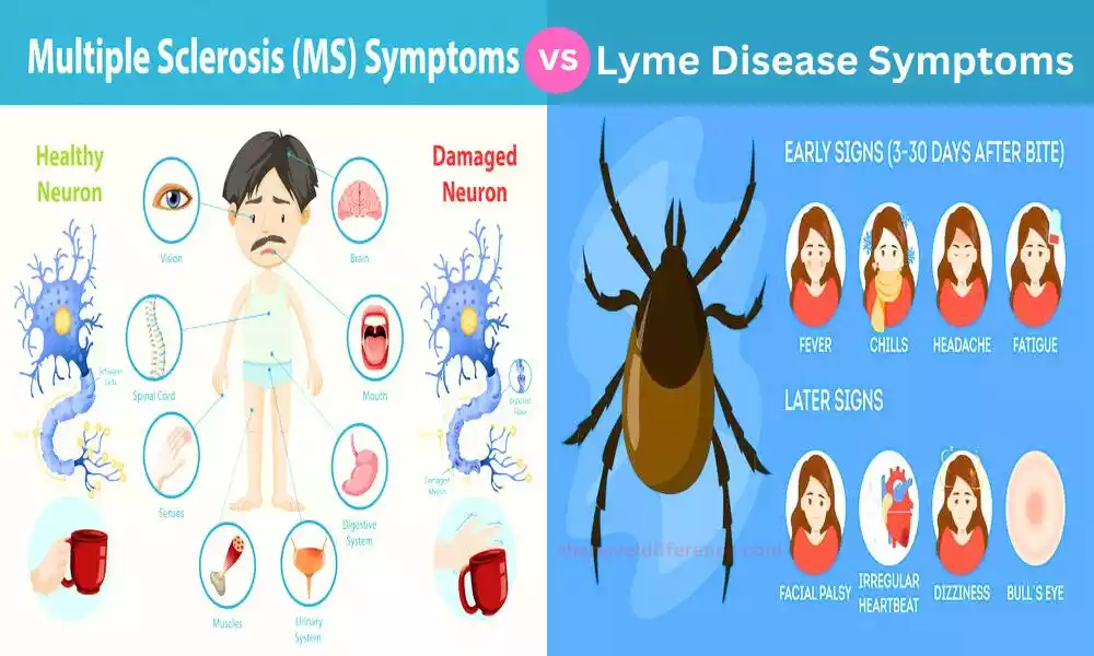 Difference Between MS and Lyme Disease