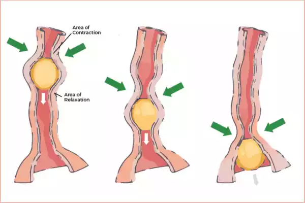 Secondary Peristalsis