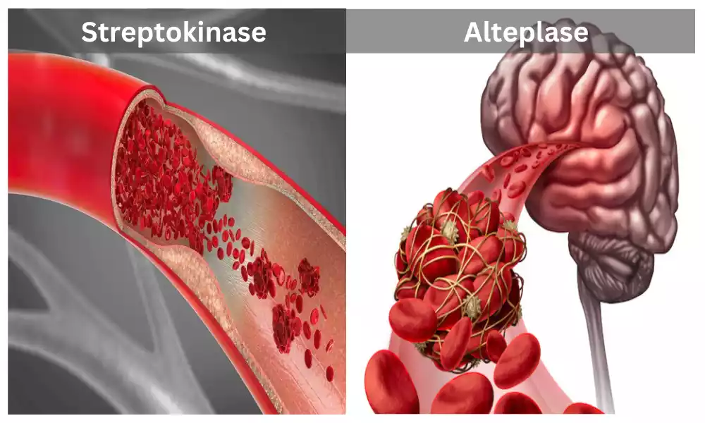 Between Streptokinase and Alteplase the top 12 difference