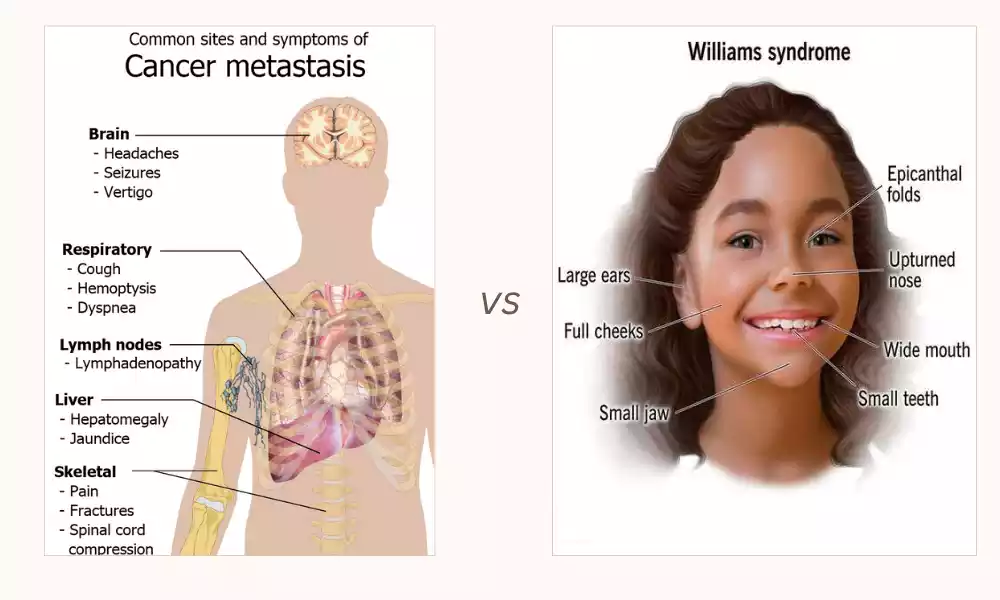 Symptom and Syndrome The best 7 Difference