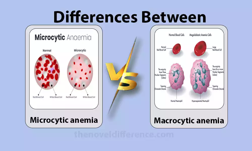 Difference Between Microcytic and Macrocytic Anemia